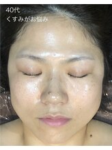 シャイニングスター 梅田店(Shining Star)/40代くすみがお悩み