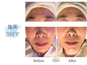 ディアスマイル(Dear.smile)/施術3回で