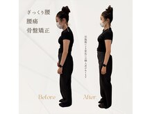 心斎橋長堀フェムテック整骨院の雰囲気(骨盤矯正&姿勢矯正で美姿勢 肩こり・整体!!男性可 心斎橋)