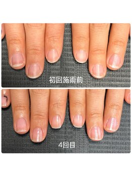 リティ(RiTY)/最強のネイルケア
