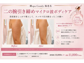 キャンディ 海老名駅前店(Candy)の写真/【大人女性に人気】薄着の季節やドレス姿に自信◎二の腕・背中ハミ肉をボディーマイクロ波リフトで徹底ケア