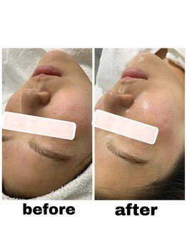 エクスクラメーションマーク(!!!)/韓国肌管理セット