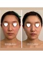 オレア(Olea) 首肩コリ/眼精疲労/顔の歪み/頭蓋から整える小顔矯正Face method