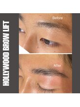 セラス(CERAS)/ハリウッドブロウリフト