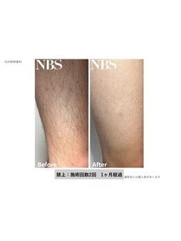 ダイアナ 出雲店(Daiana)/見ためモテ肌