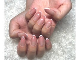 フレンチ☆フィルイン☆オフケア