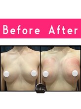 エルフラージュ 銀座店/重さがわかるほどの重量感バスト