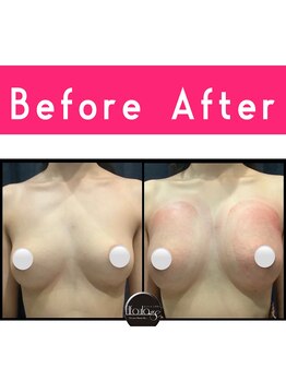 エルフラージュ 銀座店/重さがわかるほどの重量感バスト