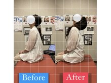 ナオル整体 宮崎院(NAORU整体)/40代女性施術事例【頸部痛改善】