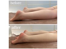 イーハンズ 渋谷本店(e-Hands)/脚のむくみ/重だるさにはこれ！