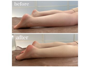 イーハンズ 渋谷本店(e-Hands)/脚のむくみ/重だるさにはこれ!