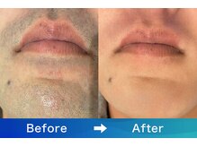 アリッサムフォーメン 岡山店(ALiSSUM for men)/アフター保証ご利用のお客様