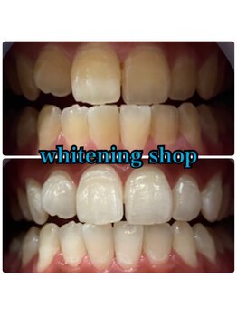 ホワイトニングショップ 葵区静岡駅店/ホワイトニング店ホワイトニング