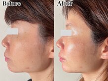 エミマス ボーテ(Emimas Beaute’)/幹細胞×毛穴洗浄で健やか美肌へ