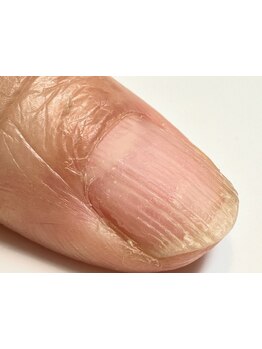 爪の悩みを解消できる（ケア含む）