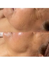 マリリン(MARILYN)/おシワケアで目元ふっくら