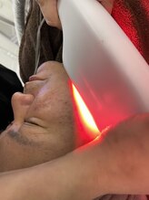 ロア(Roa)/光フェイシャル