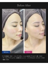 サロン ダリア(Salon Dahlia)/リフトアップコース