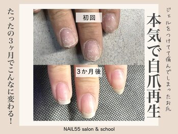 ネイルゴーゴー(NAIL55)/本気で自爪再生！