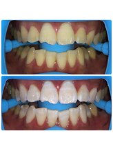 コナホワイトニング 神保町/セルフホワイトニング神保町