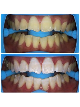 コナホワイトニング 神保町/セルフホワイトニング神保町