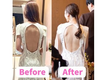 すみれ鍼灸整骨院/神戸　ブライダル美容整体