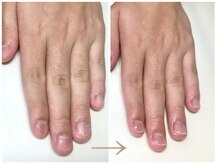アウェイク ネイル(Awake Nail)の雰囲気（どこへ行っても改善されなかった深爪をしっかりケアいたします。）