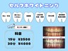 セルフホワイトニング30分　