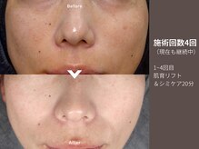 アンドアンド(&and)/くすみケアでトーンアップ◎