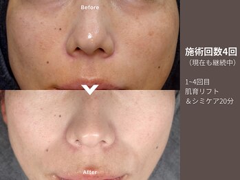 アンドアンド(&and)/くすみケアでトーンアップ◎