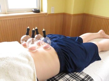 若石鈴足法 小笠原治療院/吸い玉で更に治癒力UP！