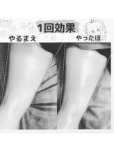 ケモ ケモ(KEMO KEMO)/