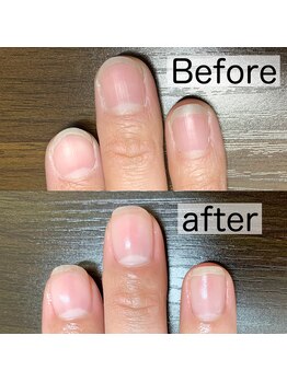 爪育成 1ヶ月の変化