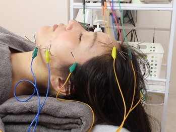 リアン鍼灸接骨院の写真/PCスマホの使い過ぎによる目の疲れ・脳疲労には”鍼灸”が効果的◎施術後のスッキリ爽快感◎試す価値有！ 