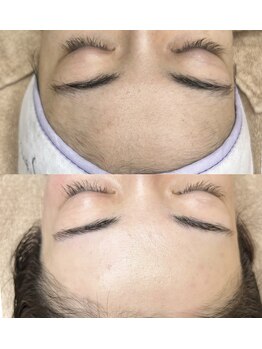 メメビューティー アンド ワキシング(meme beauty&waxing)/フェイシャルワックス