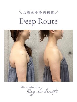 レイドボーテ(Ray de beaute)/