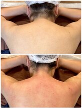 スピード美人 柏店/肩こり解消で見た目痩せ