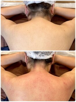 スピード美人 柏店/肩こり解消で見た目痩せ