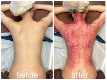 スピード美人 銀座店/肩こり解消で首は細長くなります