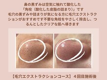 【毛穴洗浄コース】毛穴エクストラクション（60分）