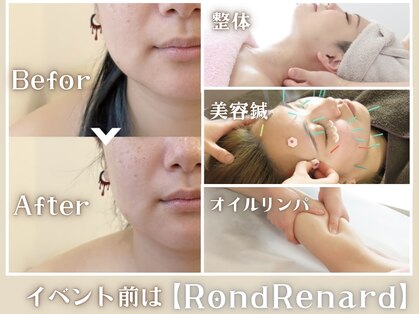 ロンルナール(Rond Renard)の写真
