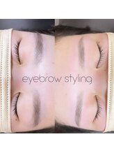 リンクス(links)/ワックス脱毛