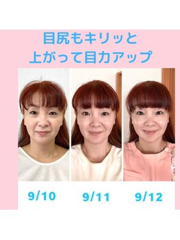 ビューティスタジオＫ/たるみ改善小顔矯正フェイシャル