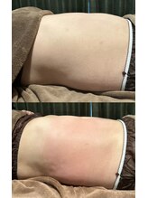 プライベートサロン ヴィヴィアン(Vivian)/キャビマックスの効果