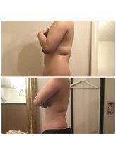 ラベルヴィ(La belle vie)/結果重視・痩身エステのお客様