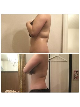 ラベルヴィ(La belle vie)/結果重視・痩身エステのお客様