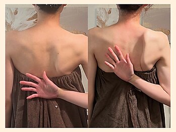 ラフリー 西宮北口院(RUFFREE)/猫背巻き肩改善に/整体90分