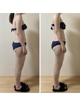 シャンタイン(SANTAI)/モンテセラピー★姿勢改善