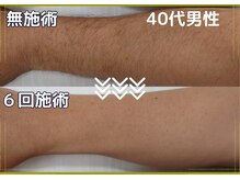 サロン ド プリエ(Salon de Plie)/セルフでも効果はしっかり！