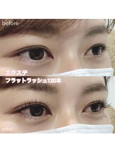 レディエント(Radiant)/フラットラッシュ120本